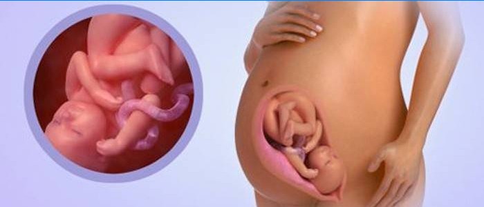 Foetus à 36 semaines de gestation