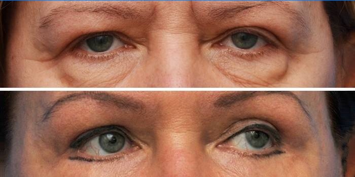Des changements notables sur le visage