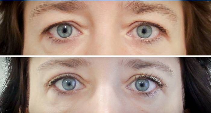 Le visage rafraîchi d'une femme de 40 ans