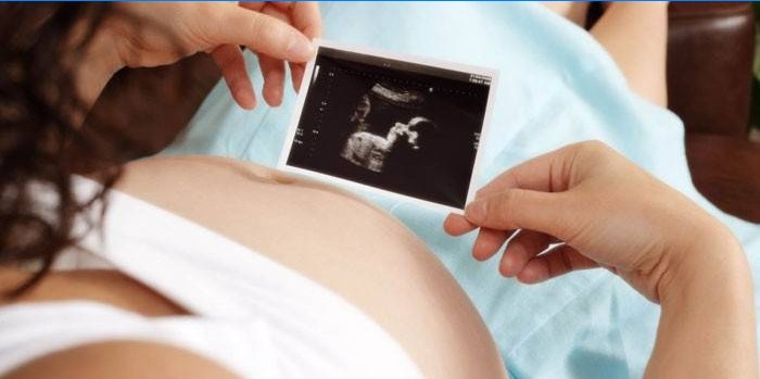 Une femme enceinte regarde l'échographie