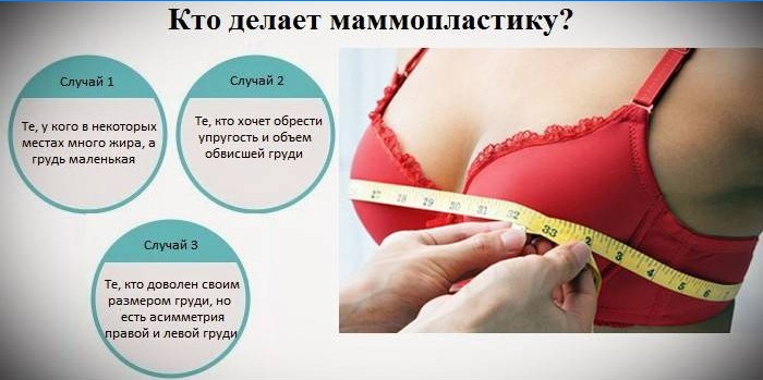 Indications pour la mammoplastie