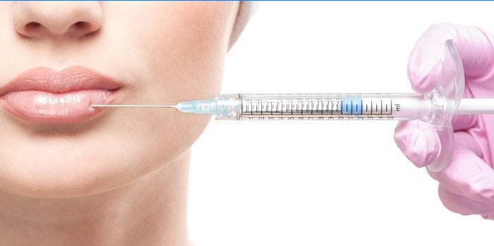 Une femme reçoit une injection de Botox sur les lèvres