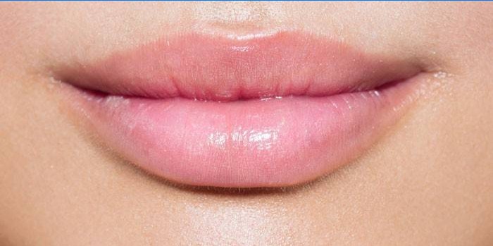 Lèvres élargies