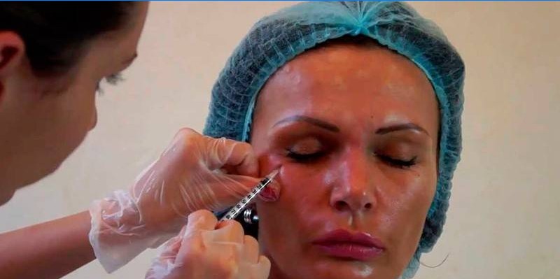 Une fille reçoit une injection cosmétique