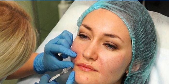 Une femme reçoit des injections dans les plis nasogéniens