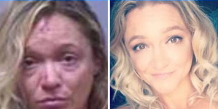 Femme avant et après abus d'alcool