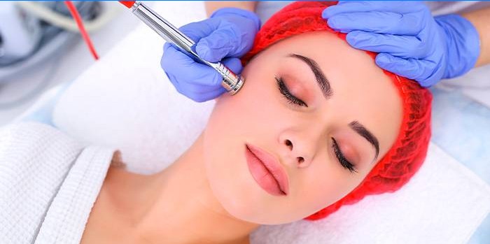 Microdermabrasion