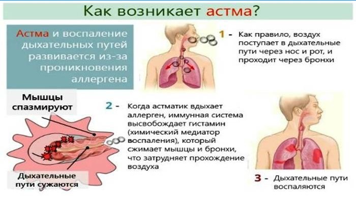 Comment l'asthme se produit-il?