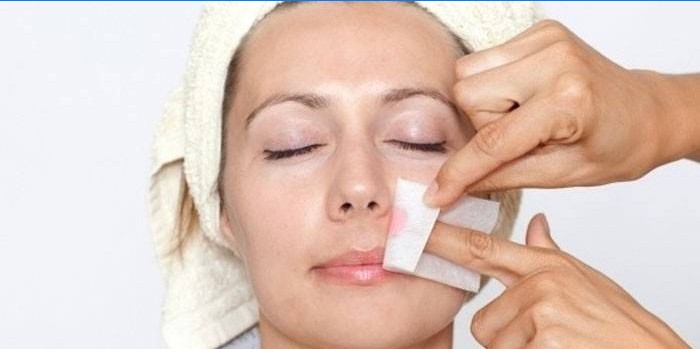 Épilation des poils du visage chez la femme
